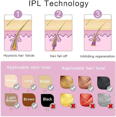 Mini Laser Hair Removal Handset – Painless, Long-Lasting Hair Reduction at Home